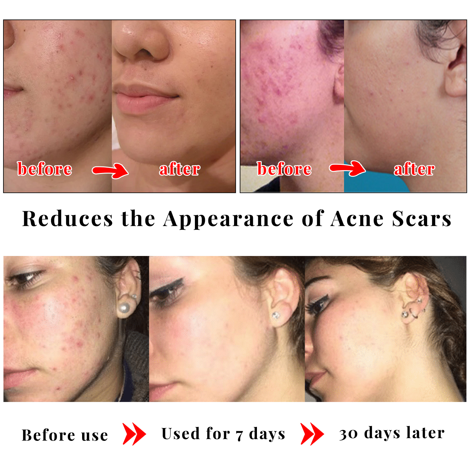 Kojic Acid Glow Soap Facial De - Skincare X2 评论和价格