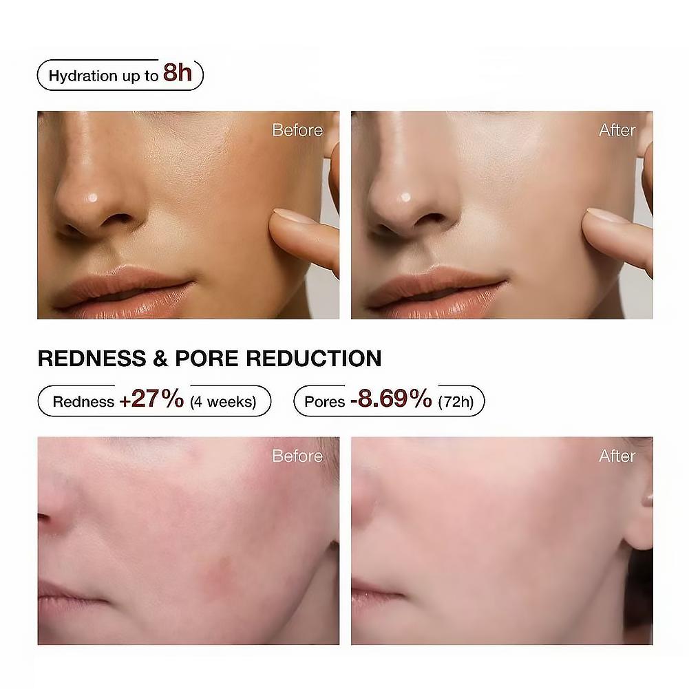 5% Niacinamide & Arbutin Serum - Niacinamide Brightening Serum 评论和价格
